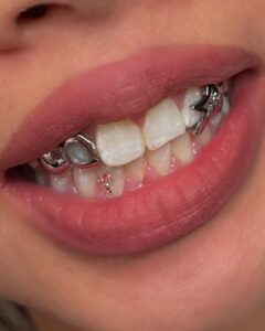 SnapInsta.to_475429121_18035514299389697_5237923549454347177_n